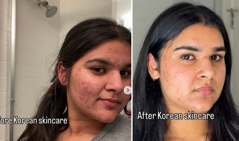 Dr. Althea 345 Cream and Stretch Fit Toner Pads. Healthy, glowing skin results.