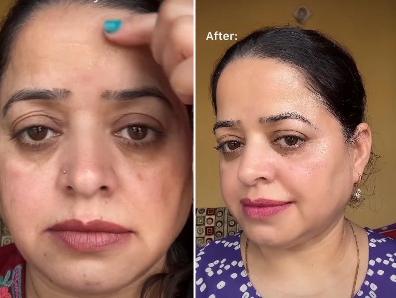 Argireline® Peptide & Copper Peptide B'tox Serum — treats fine lines, wrinkles, dark spots, hyperpigmentation. Results show smooth, plump skin.